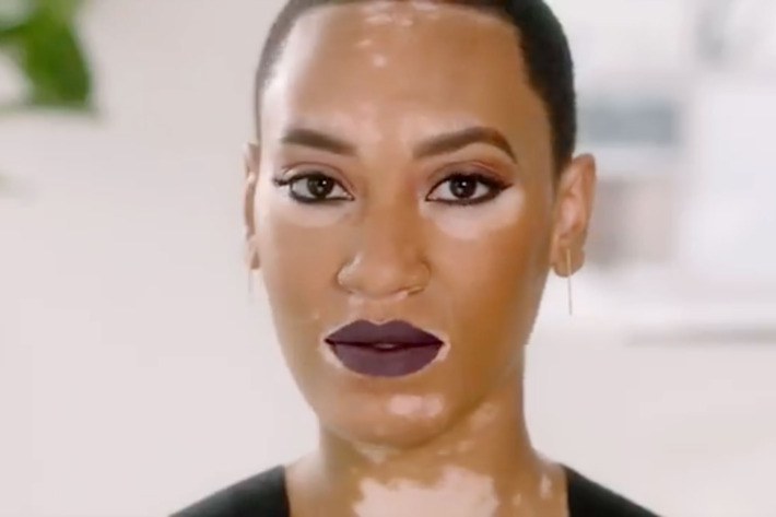 Встречайте первую модель CoverGirl с витилиго